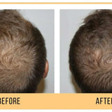 Keravive Scalp Therapy Peptide Spray 1.7 fl oz