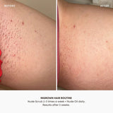 Bushbalm Nude Ingrown Hair Oil