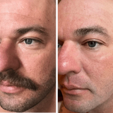 Omnilux Men
